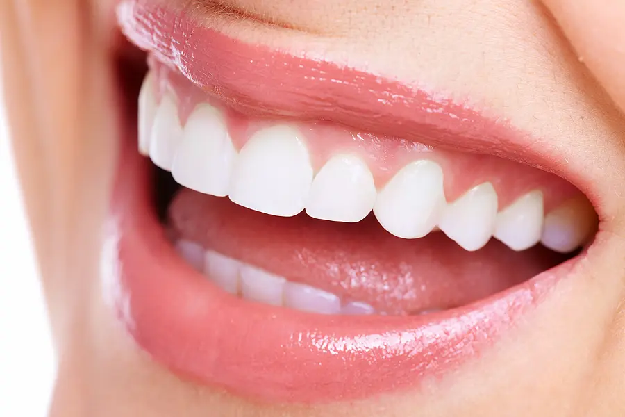 Restore Your Smile with Dental Crowns and Bridges in Palm Bay, FL