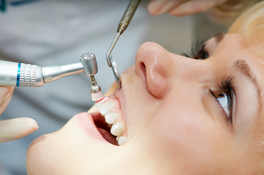 Keep Your Smile Healthy with Professional Dental Cleanings in Palm Bay, FL