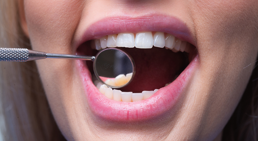 Do Dental Implants Feel Like Real Teeth? Understanding the Reality Behind the Restoration