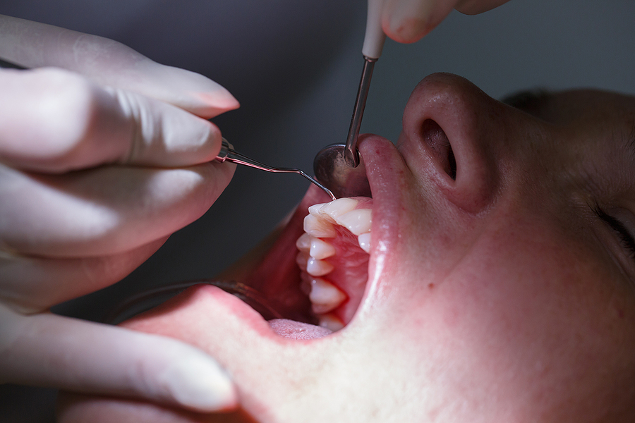 Restore Your Gum Health with Non-Surgical Periodontal Therapy in Palm Bay, FL